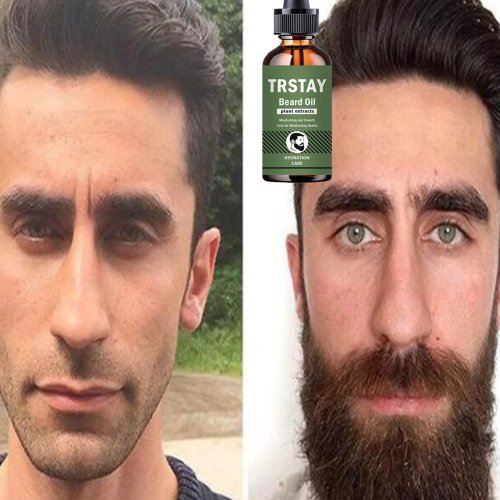 Premium Beard Oil for Men – Moisturizes, Strengthens & Promotes Healthy Growth, Reduces Frizz for a Fuller Look