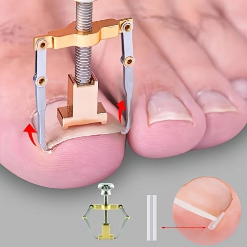 51-tlg. Profi-Set für Fußnägel & eingewachsene Nägel – Soft-Touch-Werkzeuge, unparfümierte Feile, Komplettset für schmerzfreie Pediküre und Fußhygiene