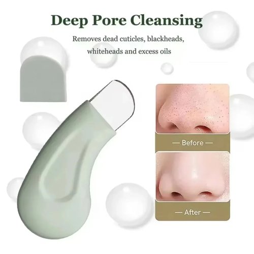 Extractor de puntos negros y blancos — Limpiador de poros para nariz y rostro, portátil