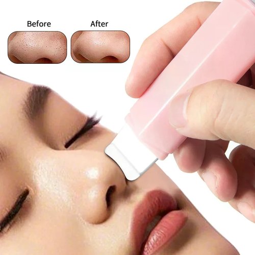 Dụng cụ lấy mụn 2 đầu - spatula/dao cạo mặt làm sạch sâu lỗ chân lông, lấy mụn đầu đen và mụn đầu trắng