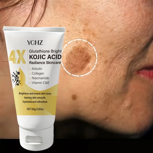 Krim Wajah Asam Kojic Pencerah Kulit – mengurangi noda hitam, meratakan warna kulit, tidak berminyak, melembapkan, untuk siang & malam, unisex