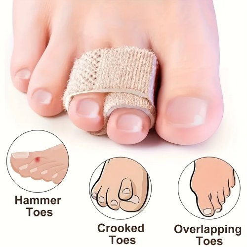 3-Pack Adjustable Toe Supports for Hammer & Crossed Toes — Reusable Polyester Toe Splints/Protectors