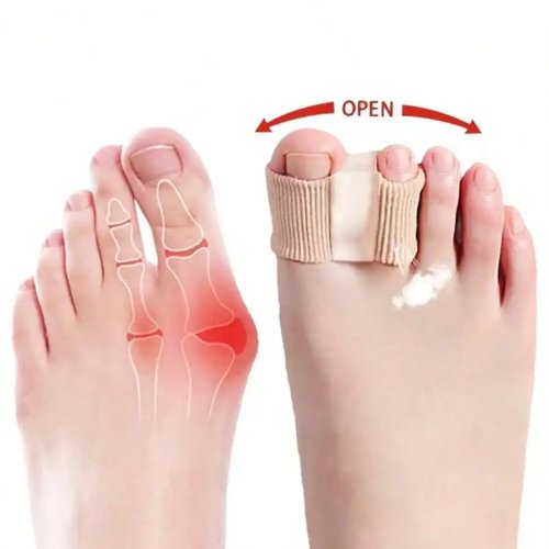 Separa‑dita per alluce valgo 2 pezzi – Sollievo dal dolore, comodi per camminare, correre, escursioni e uso quotidiano, supporto resistente per scarpe