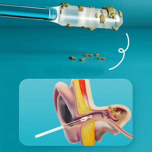 Silicone Disposable Ear Swabs — Soft Sticky Earwax Remover for Home Use