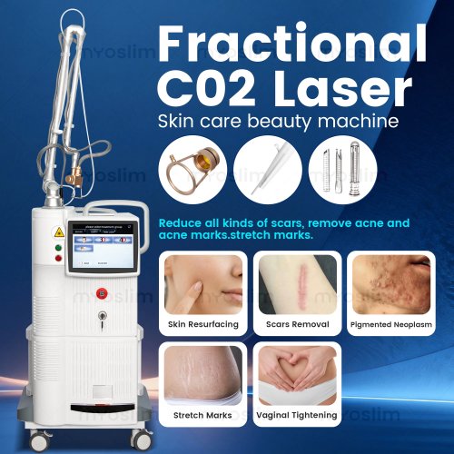 Sistema de Laser CO2 Fracionado 4D Avançado: Remoção Profissional de Cicatrizes, Reafirmação da Pele e Eliminador de Rugas