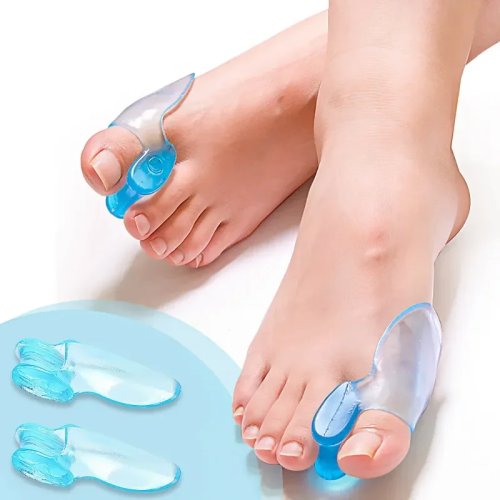 2Pcs 무지외반증 교정기 발가락 분리기 - 할룩스 발구스 스트레이트너 주야간 착용 남녀 공용 풋케어